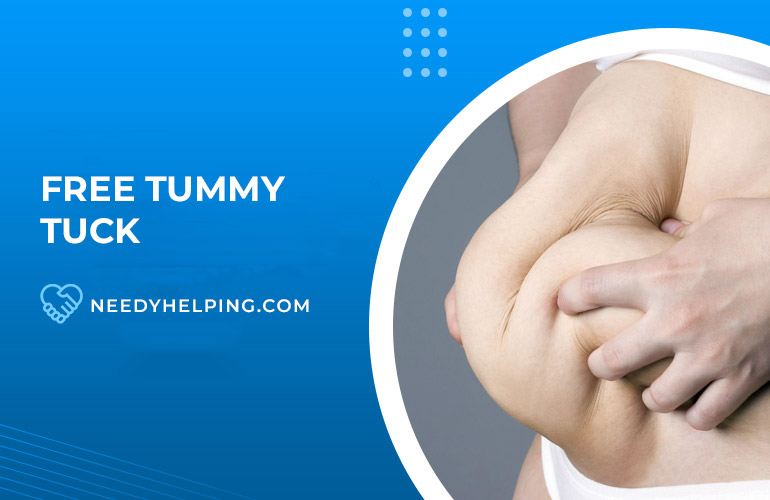 9 Ways to Get Free Tummy Tuck in 2024